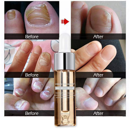 Vibrant Glamour Nail Repair Fluid Hand and Foot Nail Fungus Care Bright Nail